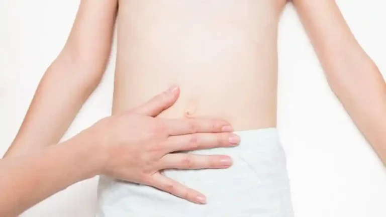 ilustrasi-hernia-1